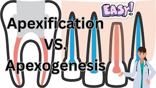 Apexification vs Apexogenesis  What’s the Difference [upl. by Baynebridge]