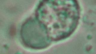 Chlamydiosis Chlamydia trachomatis [upl. by Daeriam469]