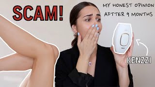 I USED KENZZI LASER HAIR REMOVAL AT HOME FOR 9 MONTHS AND THIS HAPPENED  honest review  results [upl. by Minabe266]