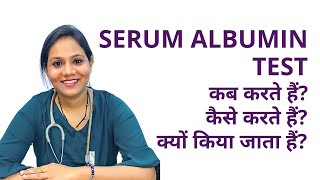 Serum Albumin Test Procedure in Hindi  Serum Albumin Test कैसे किया जाता हैं [upl. by Brodie]