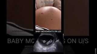 9 Months Pregnancy Baby Movement [upl. by Ahcsatan755]