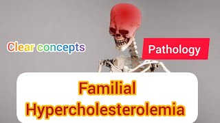 Familial Hypercholesterolemia Pathology Robbins  Genetic Pathology MAT MEDiCOS [upl. by Retluoc167]