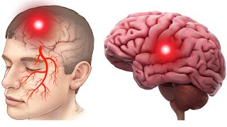 6 Warning Signs of Brain Damage 6 Symptoms You Shouldnt Ignore [upl. by Ettenad]