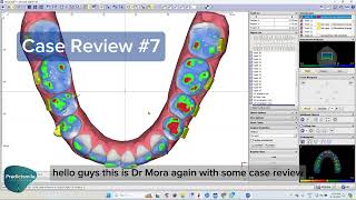 Case Review with onyxceph [upl. by Ahsenyl]