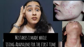 My Adapalene mistakes Using too much product  Irritationrednessdry skin Khushi Mahla [upl. by Allcot]