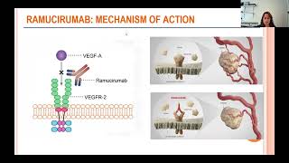 Clinical Trials for Thymic Tumors 2024 Update [upl. by Ojyllek]