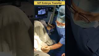 How embryo transfer is performed in IVF drrakshitamalik ivfspecialist ivfsuccess ivfjourney ivf [upl. by Aisirtap]