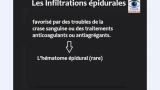 infiltration epidurale les risques et les voies dabords de infiltration epidurale [upl. by Rior]