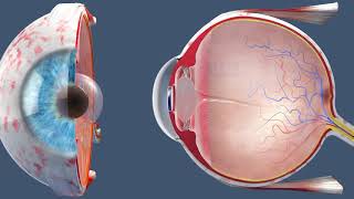 Cataract Surgery  Inside the OR [upl. by Ebag]