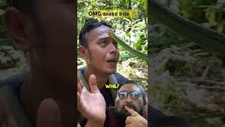 Snakebite SURVIVOR Shares Shocking Truth About Snake Attacks [upl. by Yentyrb]