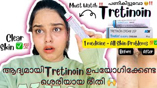 ‼️🔥Clear Skin വേണോ ⁉️😵‍💫⚠️മുഖക്കുരുകറുത്തപാടുകൾകുഴികൾ✅ How To Use Tretinoin⁉️ BEING US BY AJ [upl. by Kisor59]