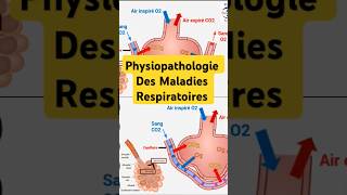 Physiopathologie Maladies Respiratoires pneumologie bronchite asthme fibrosepulmonaire poumon [upl. by Nahpets]