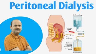 Peritoneal Dialysis  Peritoneal dialysis Class 12 biology  by Dr Bhojoo Mal [upl. by Kristal]