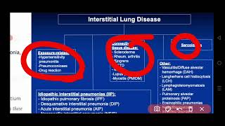 Internal Medicine  Pulmonology Diffuse Parenchymal Lung Diseases Interstitial Lung Diseases [upl. by Gerry]