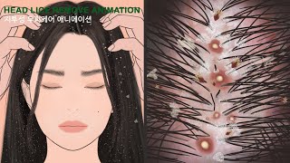 ASMR animation for removing head lice  Boredom scalp treatment [upl. by Aleahs]