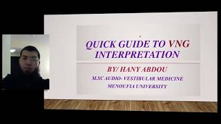 Quick Guide to VNG Interpretation [upl. by Anwahsad]