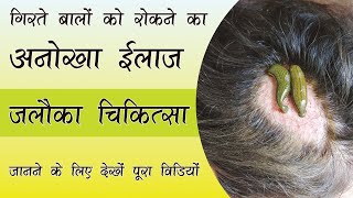 Leech Therapy for Hair Fall Acne Pimples and Blemishes  Leech Therapy for Skin Diseases [upl. by Notneuq865]