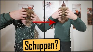 Schuppen loswerden  mehr als 10 Tipps  Trockene Kopfhaut [upl. by Midian608]