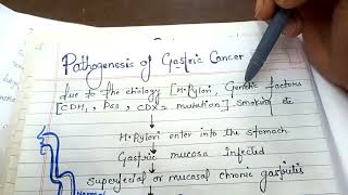 pathogenesis of gastric cancer NGMedicals [upl. by Rego656]