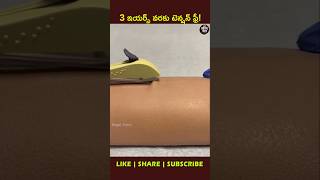 Contraceptive implant🤰youtubeshorts factsintelugu shortsfeed [upl. by Karrie]