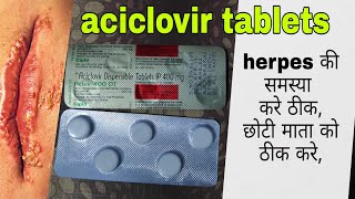 Aciclovir dispersable tablets ip 400mg  acivir tablets uses in hindi [upl. by Drofla]