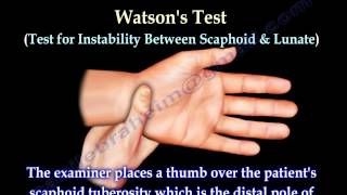 Examination Of The Hand Tests  Everything You Need To Know  Dr Nabil Ebraheim [upl. by Pietrek]