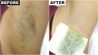 Dark Underarms amp Armpit Hair Removal  BEST amp PERMANENT Solution  Anaysa [upl. by Imot]