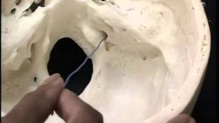 Head amp Neck Video 1 of 4 The Skull and the Intracranial Region [upl. by Kathye]