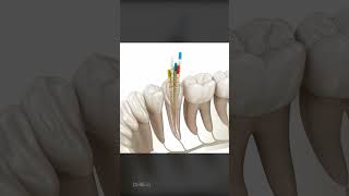 What To Expect During a Root Canal Is It Right For You [upl. by Farwell]