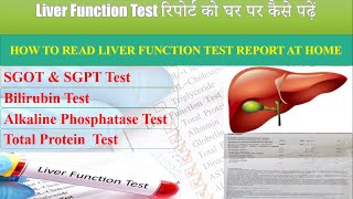 Liver Function Test LFT in Hindi  Normal Range  SGOT  SGPT  Bilirubin  ALP  Albumin [upl. by Froma]