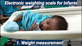 Assessment of Physical Growth by Anthropometric Measurements  Competency PE 14  Pediatrics [upl. by Latouche]