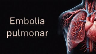 Embolia pulmonar [upl. by Adina]