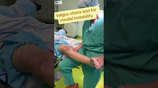 Valgus stress test for medialcollateralligament knee orthopaedics kneesurgey sportstrauma [upl. by Brunhild683]