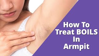 Home Treatment For Boils In Armpit That Works  Inflamed Cysts [upl. by Burn]