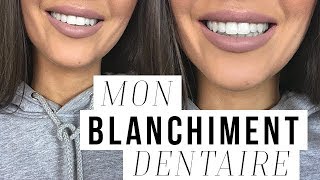 COMMENT JAI BLANCHI MES DENTS  MON BLANCHIMENT DENTAIRE [upl. by Lacsap129]