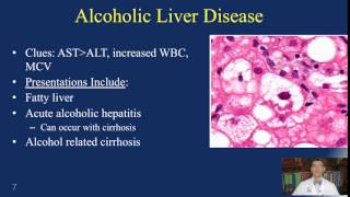 Alcoholic Liver Disease [upl. by Willtrude]