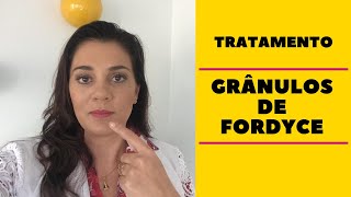 📌 TRATAMENTO PARA GRÂNULOS DE FORDYCE 👩🏻‍⚕️ [upl. by Lorilyn]