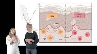 Macrophages in graftversushost disease J Strobl et al [upl. by Einej]