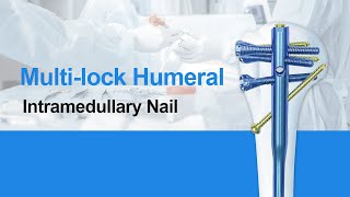 CZMEDITECH Multilock Humeral Intramedullary Nail for orthopedics implants intramedullary nail [upl. by Effy]