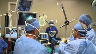 Shoulder Surgery Arthroscopy OR Setup and Patient Positioning [upl. by Annahsed]