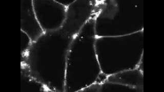 Real time confocal imaging of LHinduced endocytosis of FLAGtagged LH receptor in HEK 293 cells [upl. by Alister]