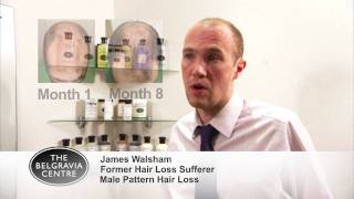 Male Hair Loss Success Story  James Walsham [upl. by Vallo]