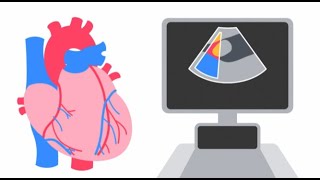 Understanding an Echocardiogram [upl. by Miles]