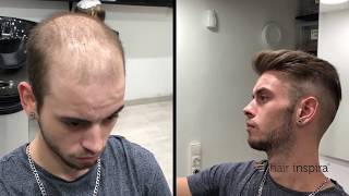 Hair Replacement fitting video David part 2 – Hair Inspira [upl. by Egdirdle]