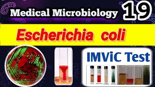 Escherichia coli part 2 شرح الشغل العملي بالعربي Identification and Laboratory diagnosis [upl. by Blatman]