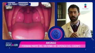 ¿Qué son las anginas ¿afecta el retirarlas  Visita de Doctor [upl. by Pals]