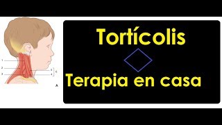 Tortícolis congénita tensión en cuello  Terapia en casa [upl. by Grobe]