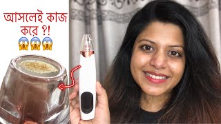 Blackheads Remover Vacuum ব্ল্যাক হেডস দূর করার পদ্ধতি ব্ল্যাক হেডস ভ্যাকিউম দিয়ে [upl. by Latsyrd73]