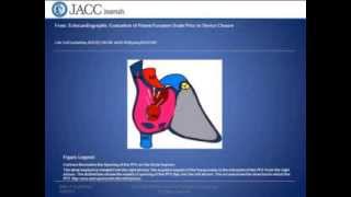 The Effect of Patent Foramen Ovale Closure in Patients with OrthodeoxiaPlatypnea Syndrome [upl. by Ludovika]