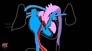 Fetal Circulation  Anatomy  Made easy  3 minutes [upl. by Eillom]